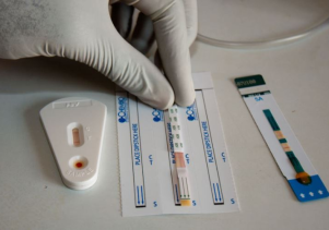 Một số điều cần biết về xét nghiệm HIV
