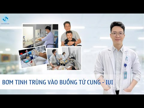 Kỹ thuật IUI